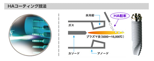 HAコーティング技法画像