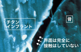 チタンインプラントと骨の界面の電顕像画像